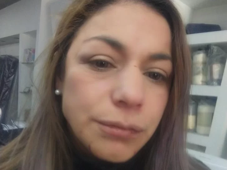 Dentro de su local, una mujer recibió una paliza por parte de familiares que no veía hace 15 años Dentro de su local, una mujer recibió una paliza por parte de familiares que no veía hace 15 años