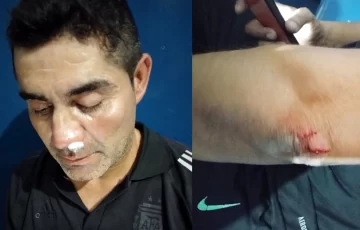 Suspensión y caos en Villa Krause