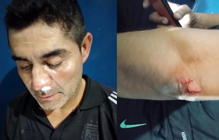 Suspensión y caos en Villa Krause