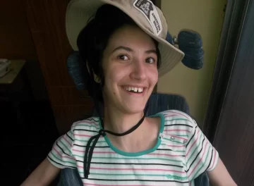 Vanita, otro caso de operación de amígdala que dejó una secuela más que dolorosa Vanita, otro caso de operación de amígdala que dejó una secuela más que dolorosa