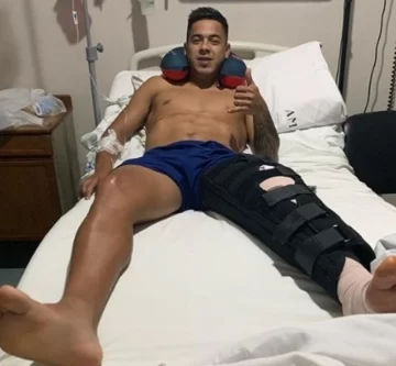 Fernández, operado con éxito Fernández, operado con éxito