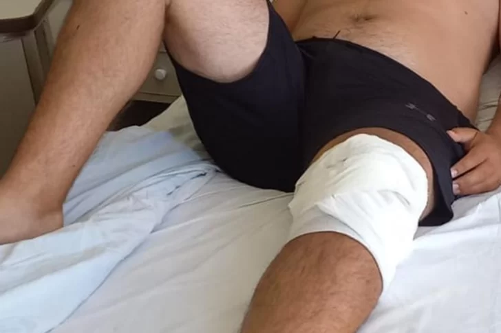 Le fracturaron la pierna de un disparo, pidió ayuda 11 horas después y dio poca información