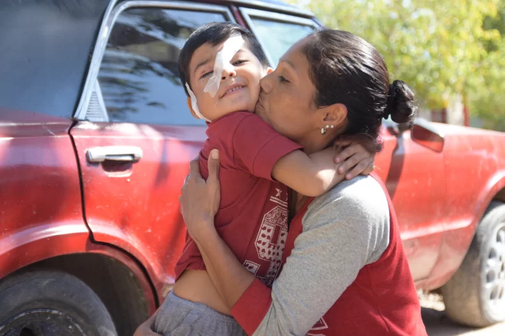 Un niño fue atacado por un perro, pero su familia duda en denunciar el caso