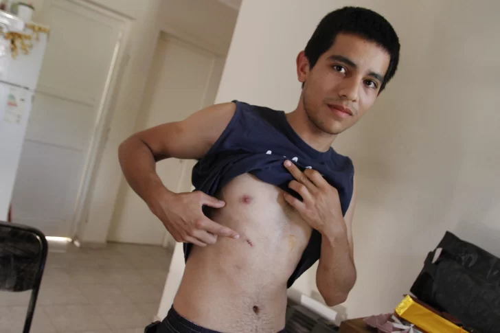 Enfrentó a dos ladrones que querían su bici y casi lo matan de un puntazo en el pecho