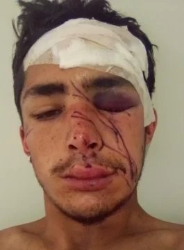 Se accidentó en moto y luego murió, hay bronca con el Hospital Rawson