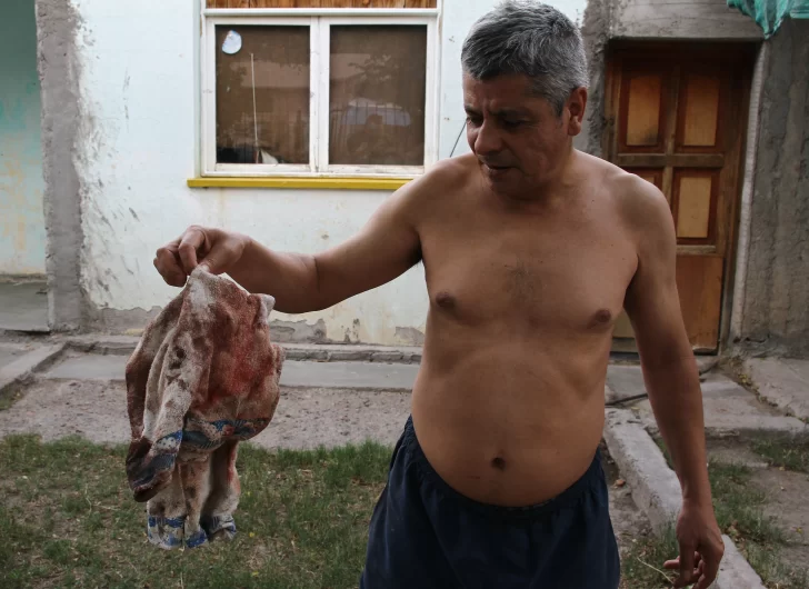 Quiso vengar un robo con un machete, pero se lo quitaron y hasta le fracturaron un brazo Quiso vengar un robo con un machete, pero se lo quitaron y hasta le fracturaron un brazo