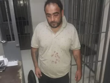 Su pareja la atacó y le arrancó parte del labio de un mordisco: la salvaron los vecinos Su pareja la atacó y le arrancó parte del labio de un mordisco: la salvaron los vecinos