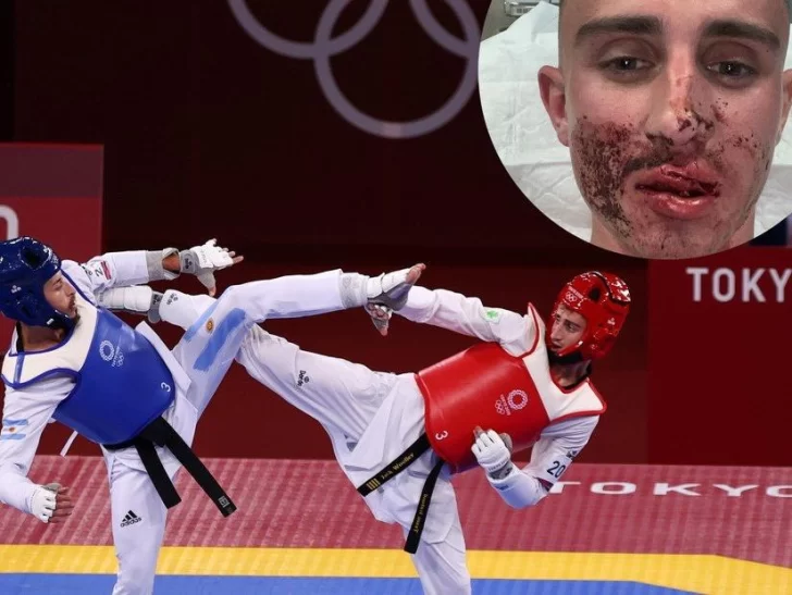 Un taekwondista olímpico fue atacado en la calle y le desfiguraron la cara Un taekwondista olímpico fue atacado en la calle y le desfiguraron la cara