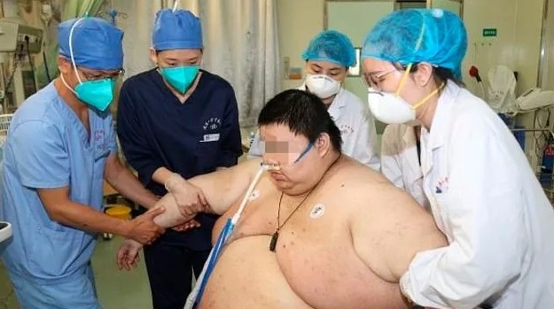 Un hombre engordó 100 kilos tras 5 cinco meses en cuarentena Un hombre engordó 100 kilos tras 5 cinco meses en cuarentena