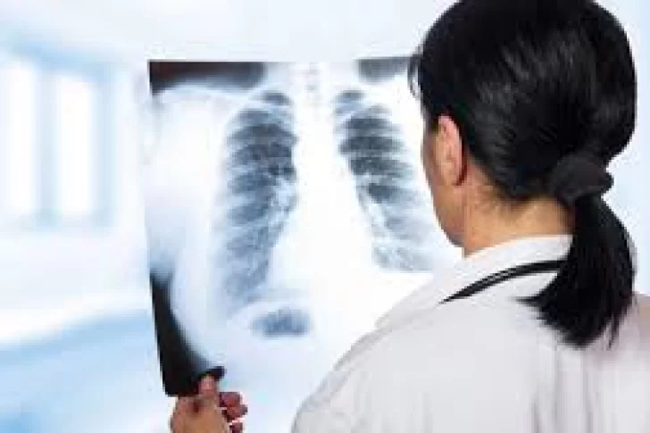 “Podría ser EPOC”: lanzan la Campaña Nacional de Concientización sobre la Enfermedad Pulmonar Obstructiva Crónica