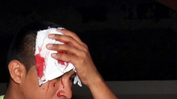 Entró a robar a una casa y le dio un botellazo en la cabeza a un joven que lo quiso detener