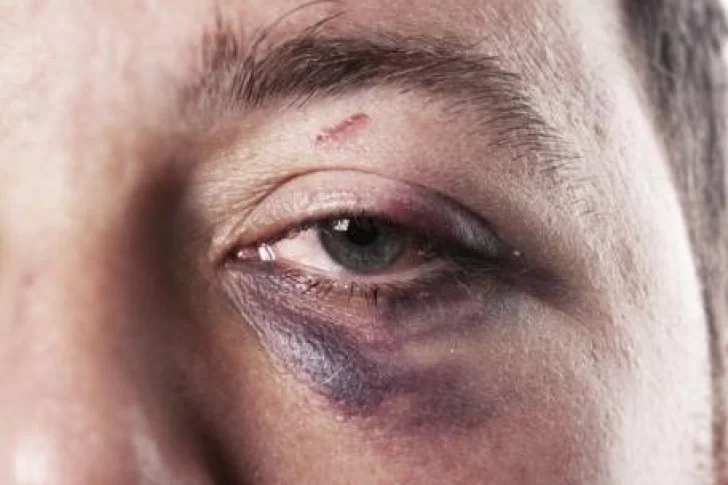 Un joven se animó a contar que su novia lo golpeaba y a pedir asistencia