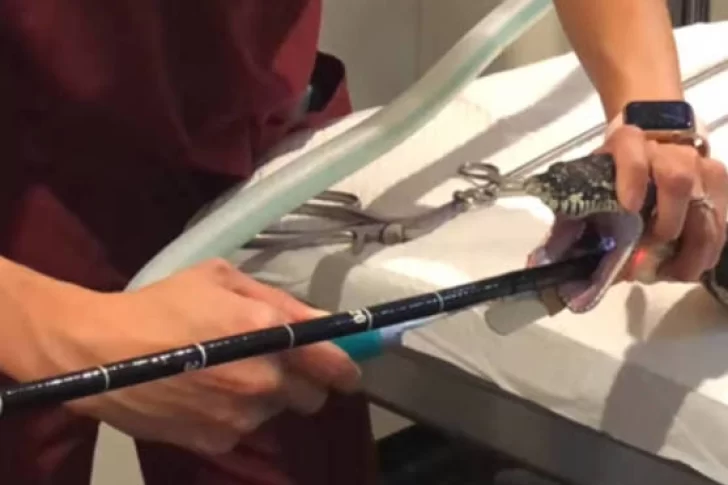 Video: extraen una toalla de tres metros de una serpiente pitón