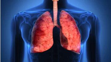 ¿Falta de aire? Podría ser Fibrosis Pulmonar Idiopática ¿Falta de aire? Podría ser Fibrosis Pulmonar Idiopática