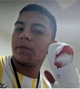 Salvaje robo a un repartidor: le cortaron 4 dedos con un machete Salvaje robo a un repartidor: le cortaron 4 dedos con un machete