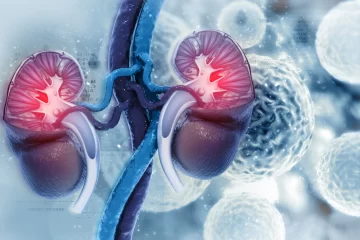 Se diagnostican 5.000 casos de cáncer renal por año en Argentina Se diagnostican 5.000 casos de cáncer renal por año en Argentina