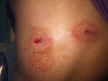 Se enojó con los vecinos, sacó un arma y empezó a disparar desde su camioneta: hirió a dos