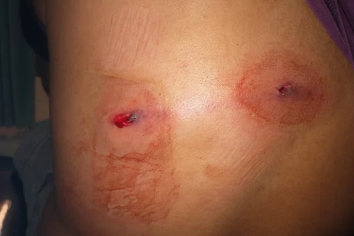 Se enojó con los vecinos, sacó un arma y empezó a disparar desde su camioneta: hirió a dos