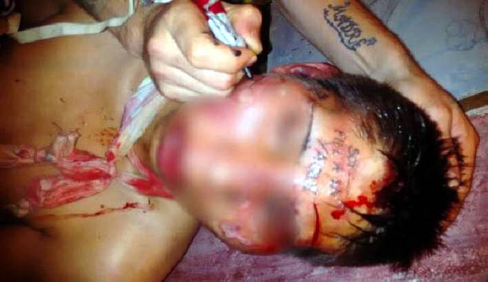 A modo de venganza, le tatuaron la frente A modo de venganza, le tatuaron la frente