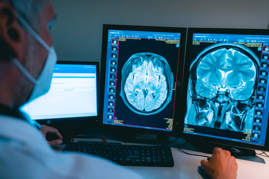 Hipófisis: una glándula que puede generar grandes problemas Hipófisis: una glándula que puede generar grandes problemas