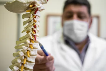 Escoliosis: claves para conocer esta afección de la columna