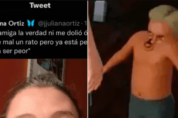 Tuvo un brote de alergia, se le deformó la cara y una amiga la hizo meme