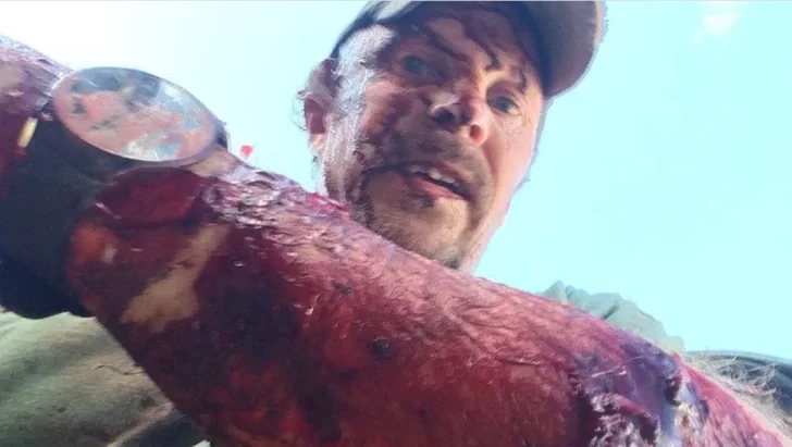 Un hombre fue atacado dos veces por un oso y vivió para contarlo Un hombre fue atacado dos veces por un oso y vivió para contarlo