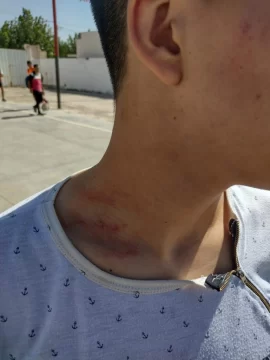 Violencia en el fútbol de inferiores: padres de Zondina golpearon a chicos de Trinidad