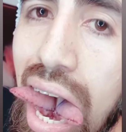 El futbolista Junior Benítez se hizo una lengua bífida El futbolista Junior Benítez se hizo una lengua bífida