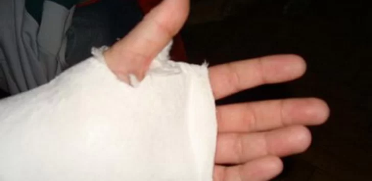 Un niño cayó de un columpio y terminó fracturado y con un fuerte golpe en la cabeza Un niño cayó de un columpio y terminó fracturado y con un fuerte golpe en la cabeza