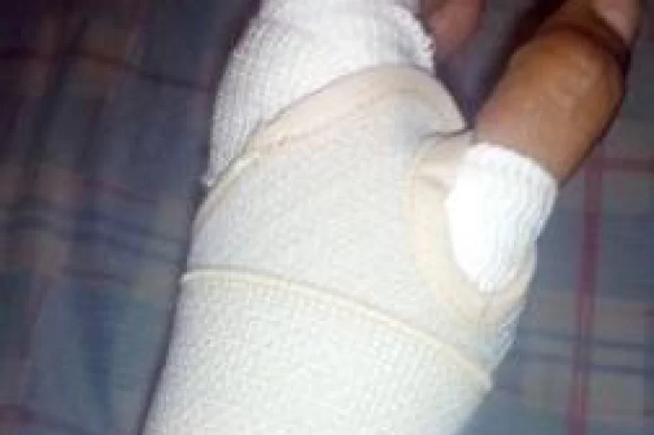 Un hombre de 64 años trabajaba con una amoladora y se provocó graves heridas en la mano
