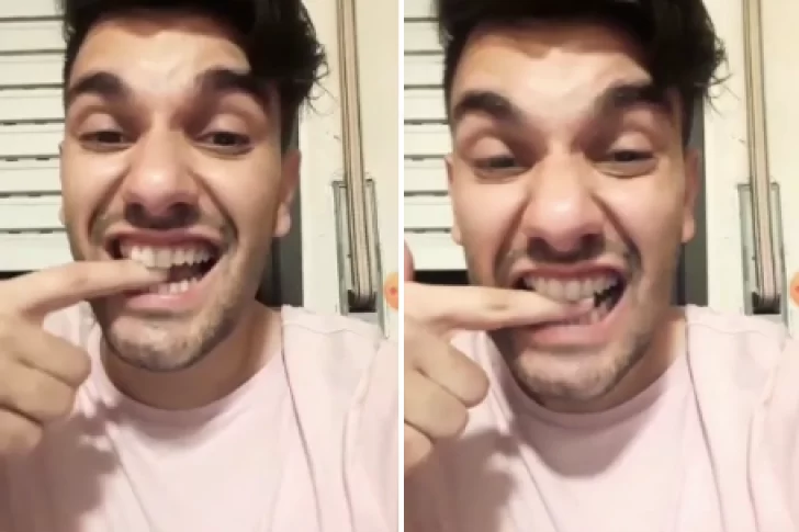 El doloroso inconveniente de un instagramer sanjuanino con su boca