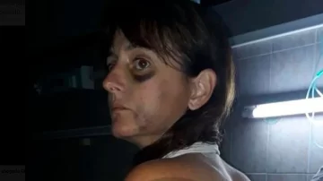 Indignante: su novia lo dejó, la golpeó brutalmente pero lo liberaron Indignante: su novia lo dejó, la golpeó brutalmente pero lo liberaron