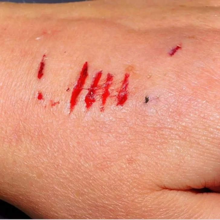 “Si te veo con otra, te mato”: el calvario que denunció un hombre con su ex de celos y golpes “Si te veo con otra, te mato”: el calvario que denunció un hombre con su ex de celos y golpes