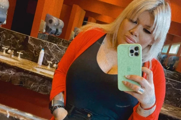 Morena Rial mostró cómo le quedó un curioso retoque estético