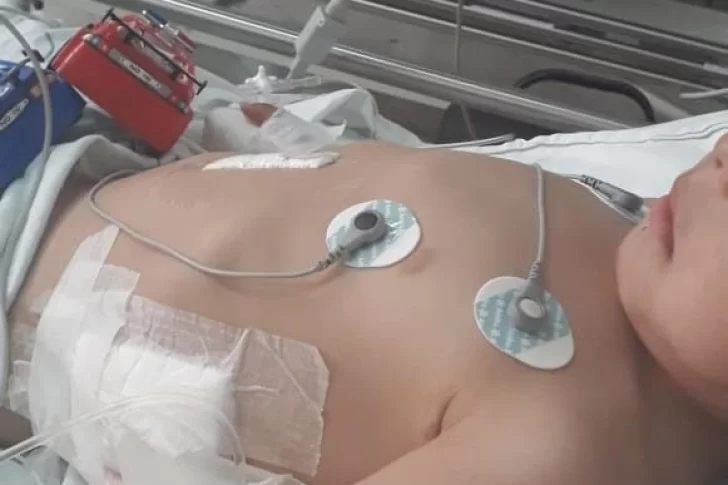 Feroz ataque de dos dogos y un pitbull a un nene de 3 años