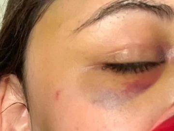 Dos hombres ingresaron a su casa y la golpearon para robarle, la salvaron sus gritos