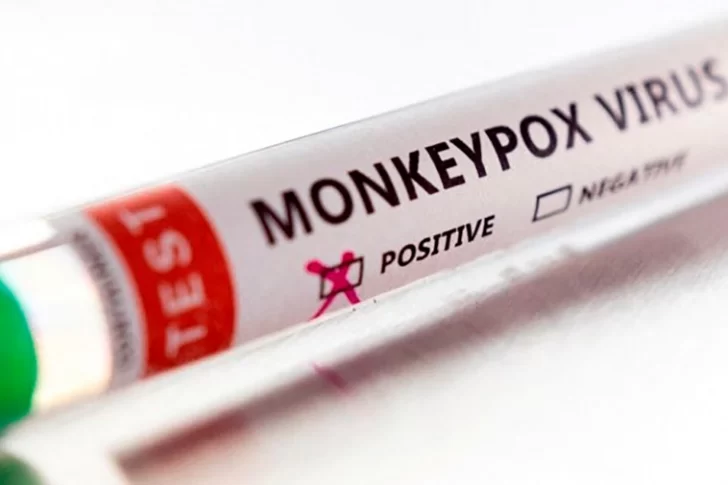 La OMS confirmó 780 casos de viruela del mono en 27 países donde el virus no es endémico