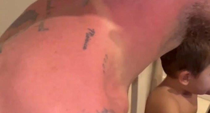 “Papu” Gómez mostró cómo quedó luego de los festejos en la caravana “Papu” Gómez mostró cómo quedó luego de los festejos en la caravana