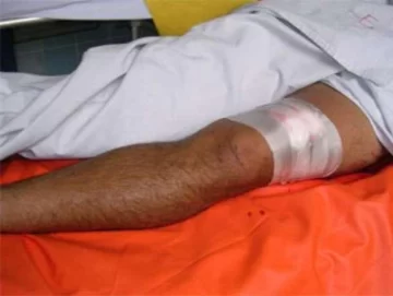 Le dispararon en las dos piernas para robarle Le dispararon en las dos piernas para robarle