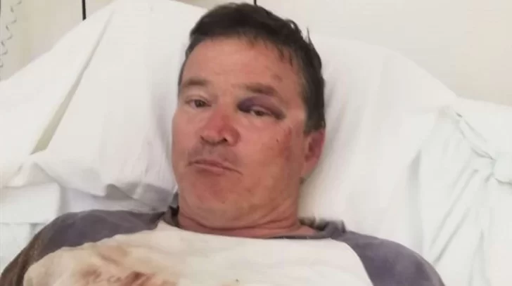 Golpearon salvajemente a un productor rural para robarle su auto, $200.000 y 10 corderos Golpearon salvajemente a un productor rural para robarle su auto, $200.000 y 10 corderos