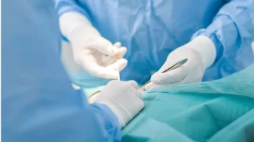 Creían que tenía un tumor pero eran gasas que olvidaron en una operación hace dos años Creían que tenía un tumor pero eran gasas que olvidaron en una operación hace dos años