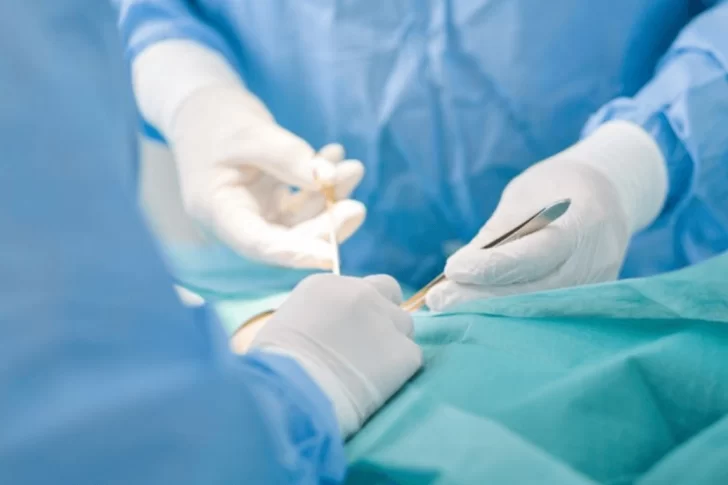Creían que tenía un tumor pero eran gasas que olvidaron en una operación hace dos años
