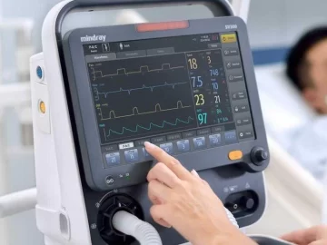 Coronavirus: cuántos respiradores hay en el país y cuántos hacen falta