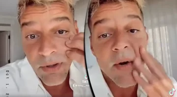 Ricky Martin explicó qué es lo que le pasó en la cara: “No tengo nada que esconder” Ricky Martin explicó qué es lo que le pasó en la cara: “No tengo nada que esconder”