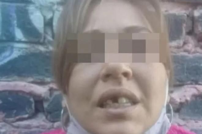 Tres años de cárcel para el sujeto que golpeó a su pareja y le quemó la mano con una estufa Tres años de cárcel para el sujeto que golpeó a su pareja y le quemó la mano con una estufa