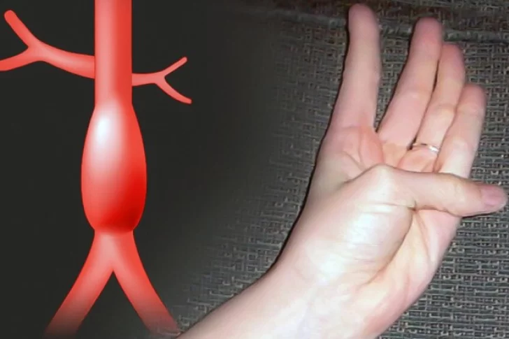 Como saber si se padece una condición cardiovascular grave con el movimiento de un dedo