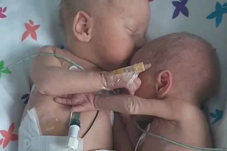 Dos gemelas prematuras separadas al nacer se dieron un abrazo al reencontrarse