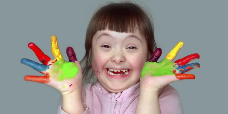 Por qué hoy se conmemora el Día Mundial del Síndrome de Down Por qué hoy se conmemora el Día Mundial del Síndrome de Down