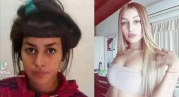 La novia de L-Gante mostró el resultado del nuevo retoque estético que se hizo en los labios